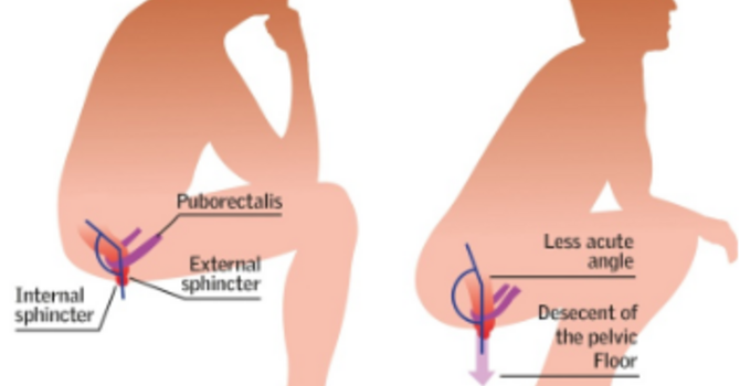The Proper Way To Poop